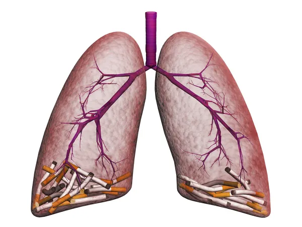 5 Reasons to detox your lungs, if you're a smoker
